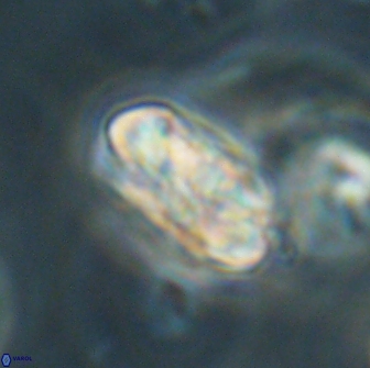 Heliolithus iptamenosdiskos 65862