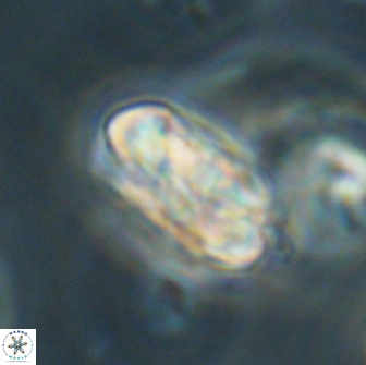Heliolithus iptamenosdiskos 65862