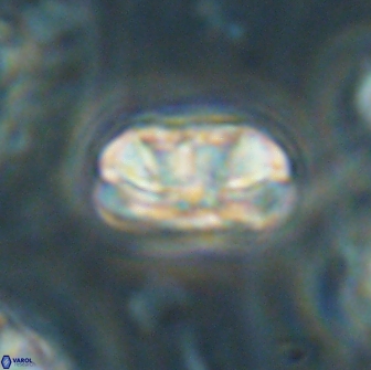 Heliolithus iptamenosdiskos 65865