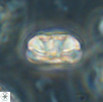 Heliolithus iptamenosdiskos 65865