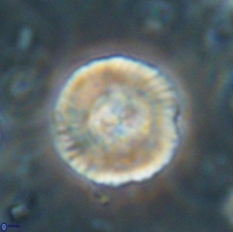 Heliolithus iptamenosdiskos 65870