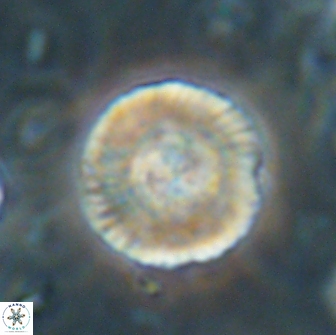 Heliolithus iptamenosdiskos 65871
