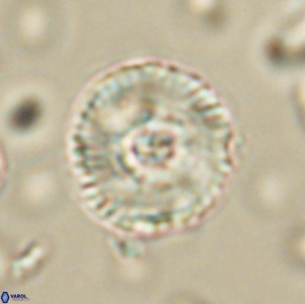 Heliolithus iptamenosdiskos 65872