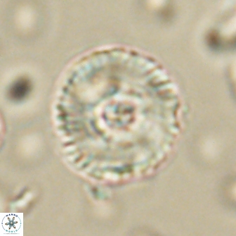 Heliolithus iptamenosdiskos 65872