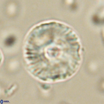 Heliolithus iptamenosdiskos 65873