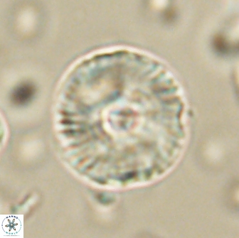 Heliolithus iptamenosdiskos 65873