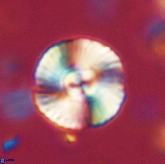 Heliolithus iptamenosdiskos 65876