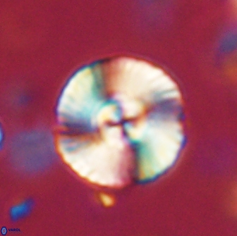 Heliolithus iptamenosdiskos 65877