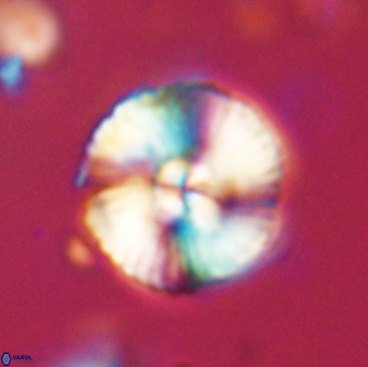 Heliolithus iptamenosdiskos 65880