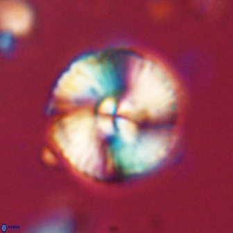 Heliolithus iptamenosdiskos 65881