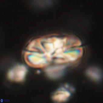 Heliolithus iptamenosdiskos 70461