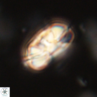 Heliolithus iptamenosdiskos 70485