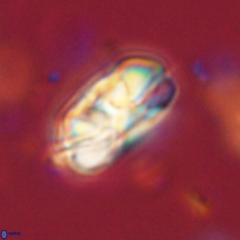 Heliolithus iptamenosdiskos 70486