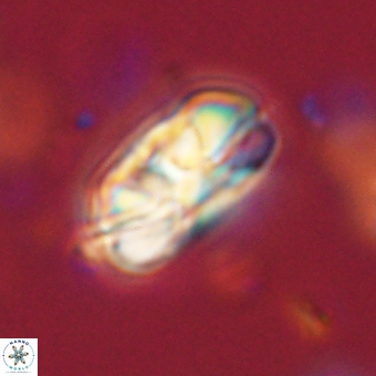 Heliolithus iptamenosdiskos 70486