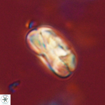 Heliolithus iptamenosdiskos 70490