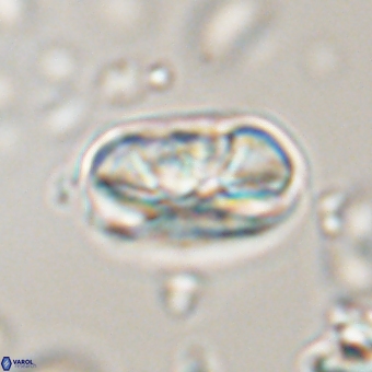 Heliolithus iptamenosdiskos 70491