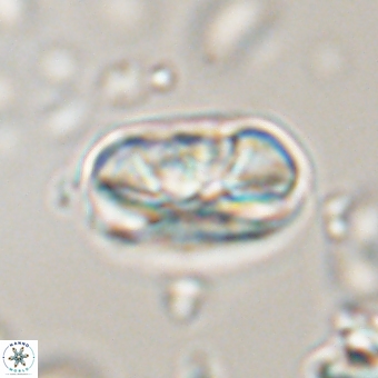 Heliolithus iptamenosdiskos 70491