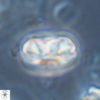 Heliolithus iptamenosdiskos 70492