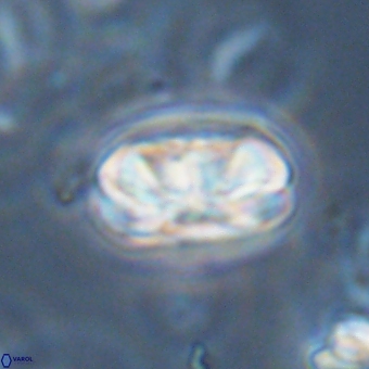 Heliolithus iptamenosdiskos 70493