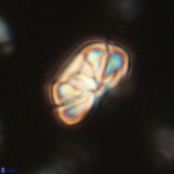 Heliolithus iptamenosdiskos 70494