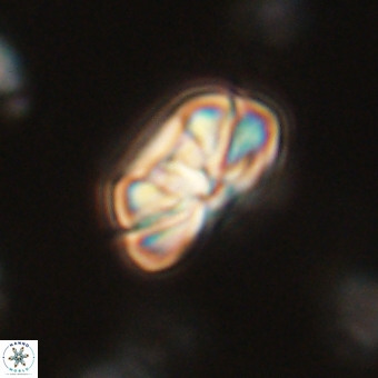 Heliolithus iptamenosdiskos 70494