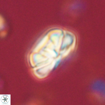 Heliolithus iptamenosdiskos 70495