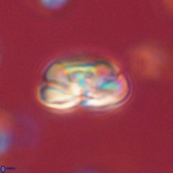 Heliolithus iptamenosdiskos 70496