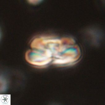Heliolithus iptamenosdiskos 70497
