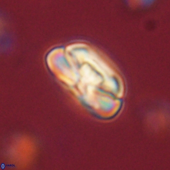 Heliolithus iptamenosdiskos 70502