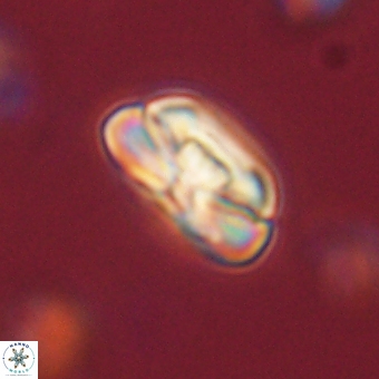 Heliolithus iptamenosdiskos 70502