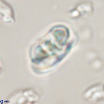 Heliolithus iptamenosdiskos 70509