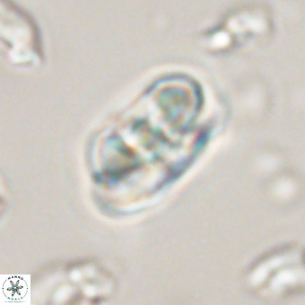 Heliolithus iptamenosdiskos 70509