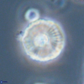 Heliolithus iptamenosdiskos 70513