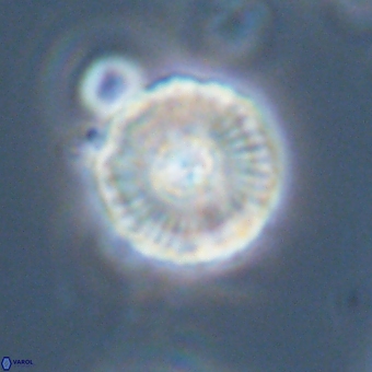 Heliolithus iptamenosdiskos 70514