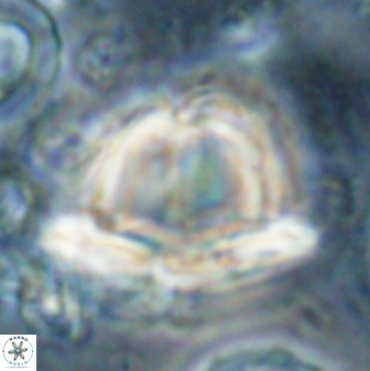 Heliolithus knoxii 61461
