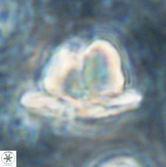 Heliolithus knoxii 61462