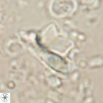 Heliolithus knoxii 61470