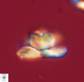 Heliolithus knoxii 61572
