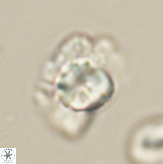 Heliolithus knoxii 61577