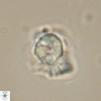 Heliolithus knoxii 61598