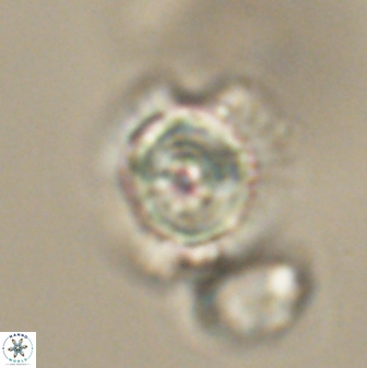 Heliolithus knoxii 61635