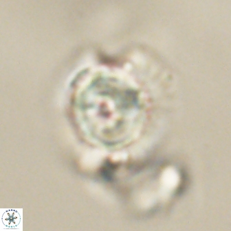 Heliolithus knoxii 61637