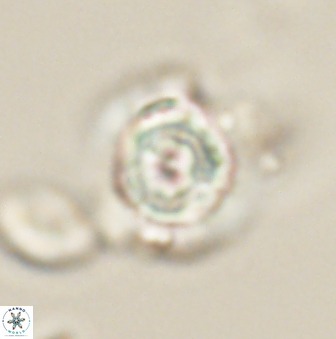 Heliolithus knoxii 61651