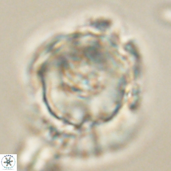 Heliolithus knoxii 61741