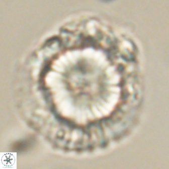 Heliolithus knoxii 61743