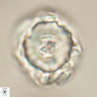 Heliolithus knoxii 61747