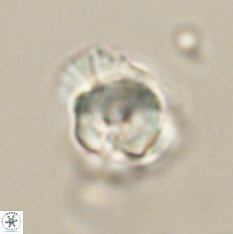 Heliolithus knoxii 61777