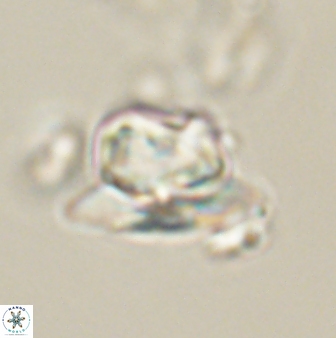 Heliolithus knoxii 61782