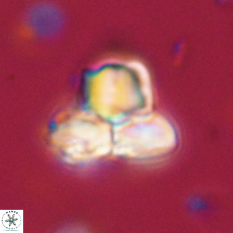 Heliolithus knoxii 69403