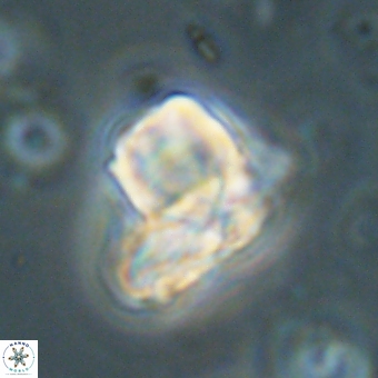 Heliolithus knoxii 69411